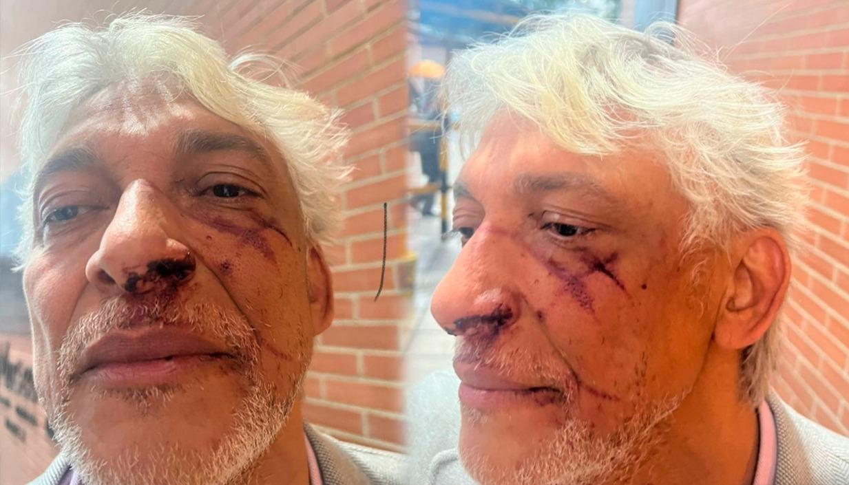 Cristóbal Padilla denuncia a su expareja